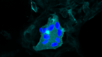 Longafweercellen kunnen allergische klachten verergeren